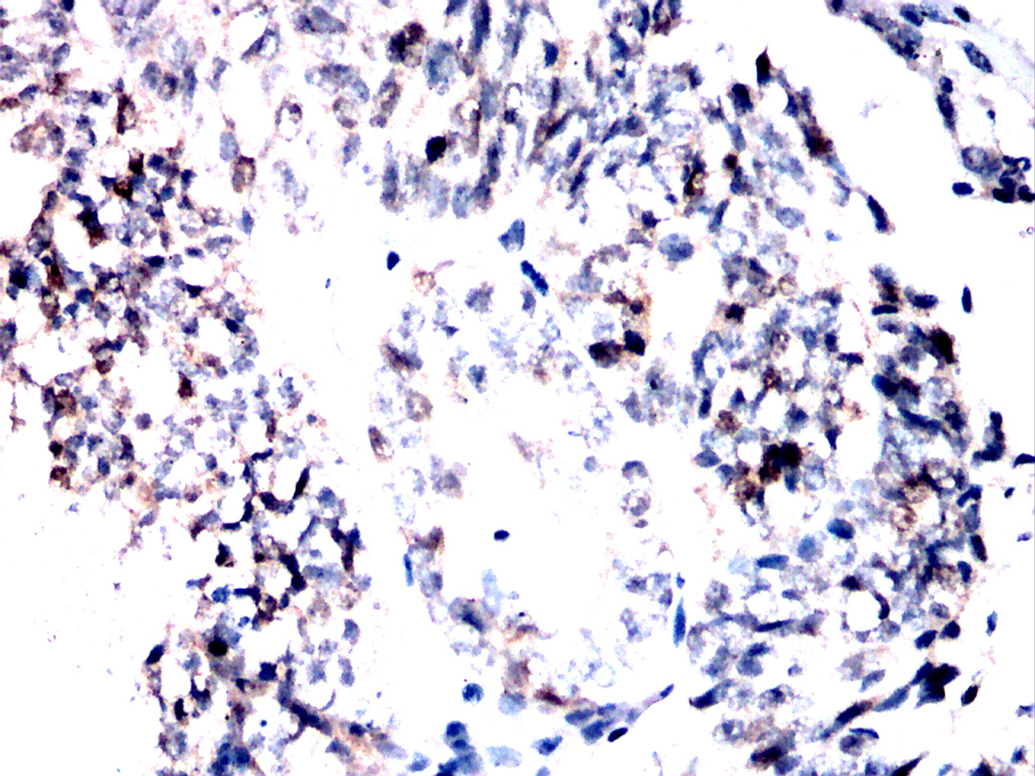 IHC